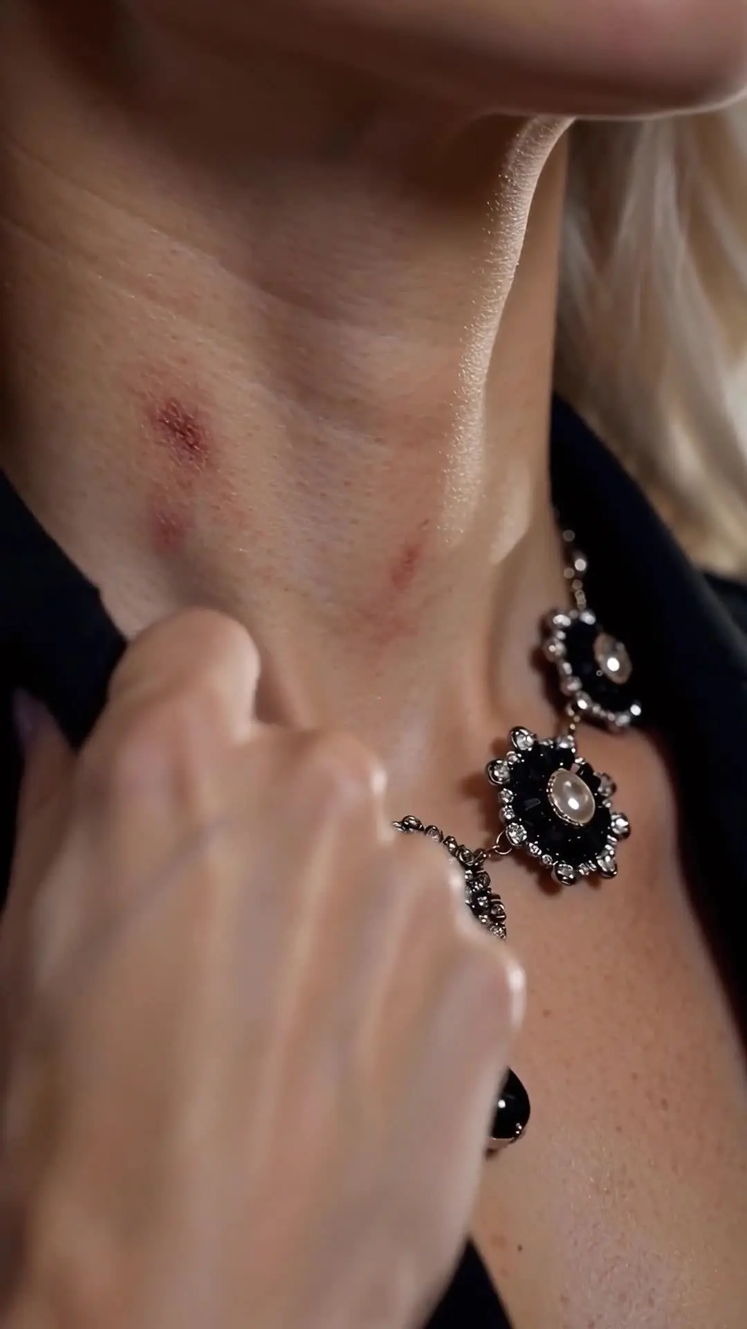 Episódio 18 de Coroado em Sangue de Prata